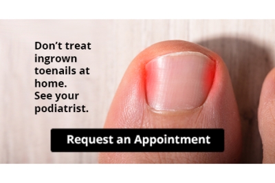 Let the Expert Treat Your Ingrown Toenails